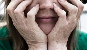 Person with head in hands, fingers spread over most of the face.